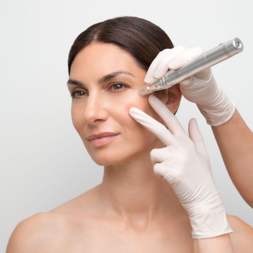 MICRONEEDLIN FACIAL-Centre d'estètica Mayka