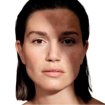 MESOPEEL-Centre d'estètica Mayka